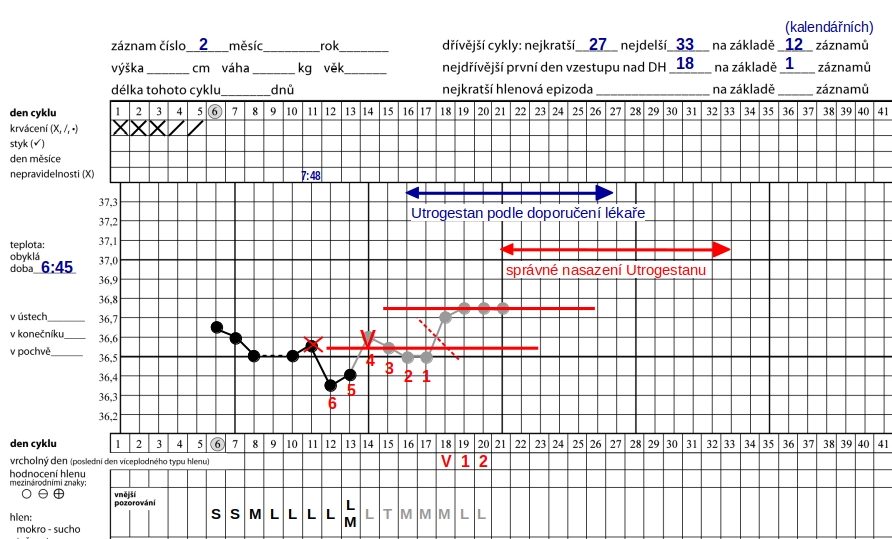 Z e-mailu lektorů STM III.: zkrácená luteální fáze